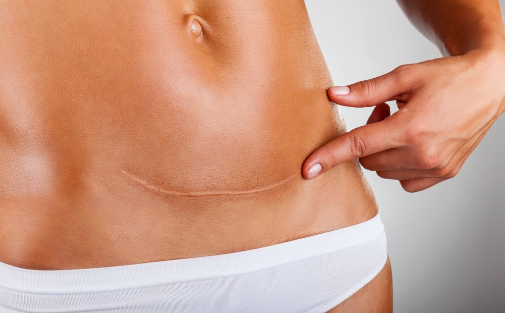 CranleyClinic's tweet photo. A recent study in Denmark shows that early Fraxel laser treatment to scars improved scar quality and appearance. This confirms our approach to scars and other skin problems with our Fraxel lasers at the Cranley Clinic. https://t.co/Dldc1j4Ie7