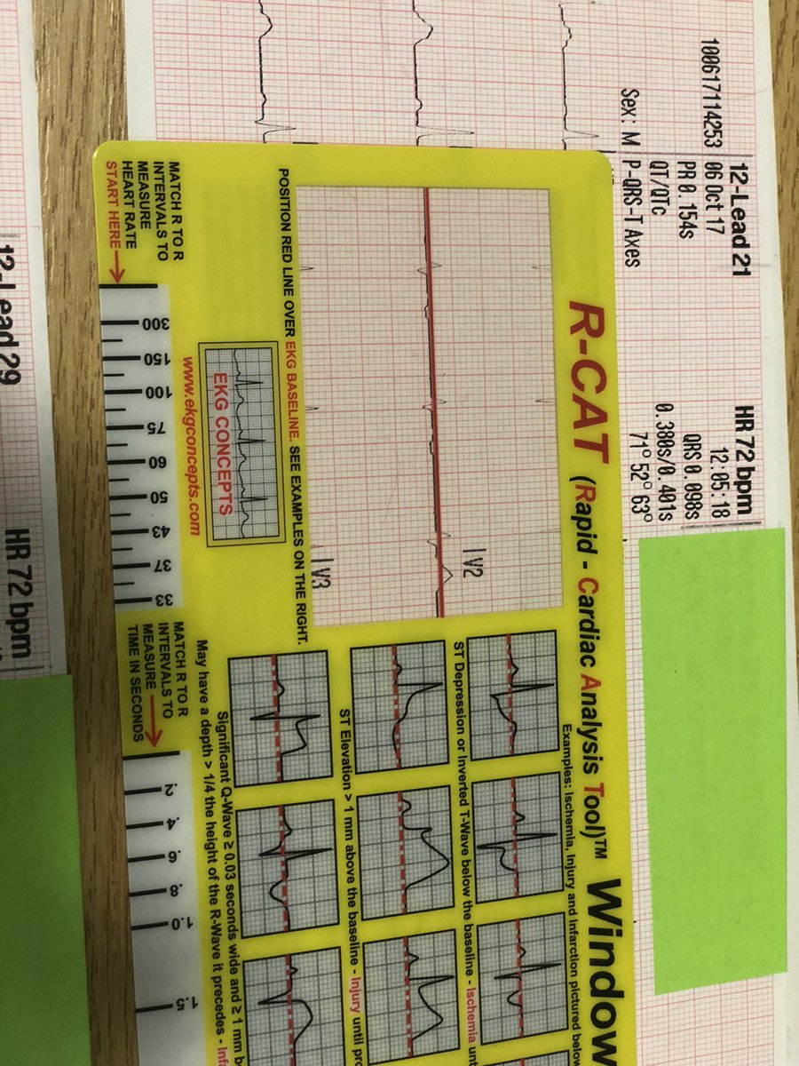 medicalaidememo's tweet photo. #FridayFeeling #Competition time. For a chance to #win one of our brilliant #rcat #ECG interpretation #Windows please #follow us #like and #retweet this tweet. #paramedic #nurse #medic #EAC #EMT #EMS ECGchat #ecginterpretation #ambulance #learningtool #student #cardiac https://t.co/ekPj5ATPki