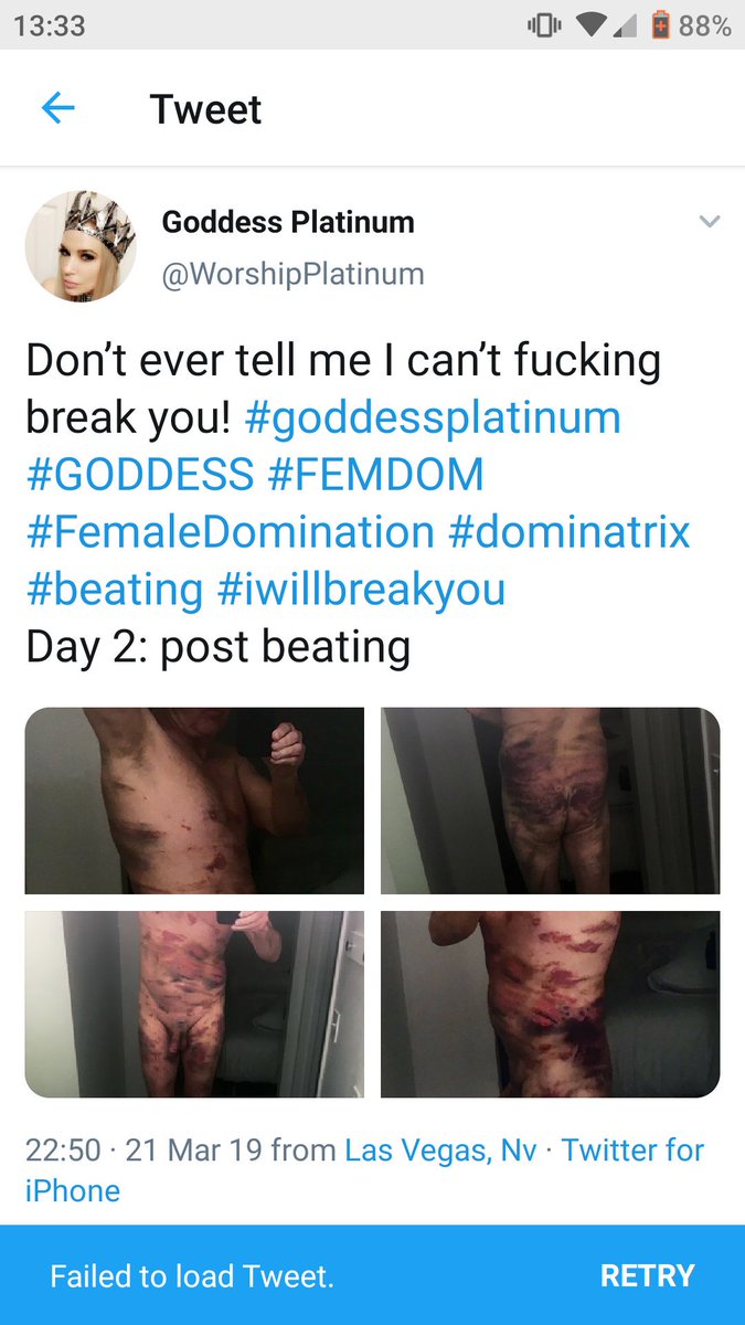 @WorshipPlatinum has taken this tweet down but poor skills are all over her feed.

This isn't BDSM. It's potentially leathal.

Stick to foot worship dear unless you've learnt how and where to strike.

(Sorry but this kind of 'play' boils my piss and disrespects the craft)