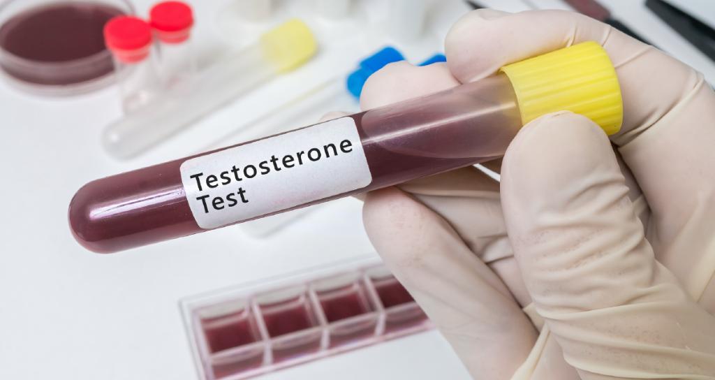 MedscapeOnc's tweet image. Testosterone replacement therapy decreased the risk for biochemical recurrence in some men and delayed time to recurrence in others, findings that took investigators by surprise. ms.spr.ly/6014T1E0q #EAU2019