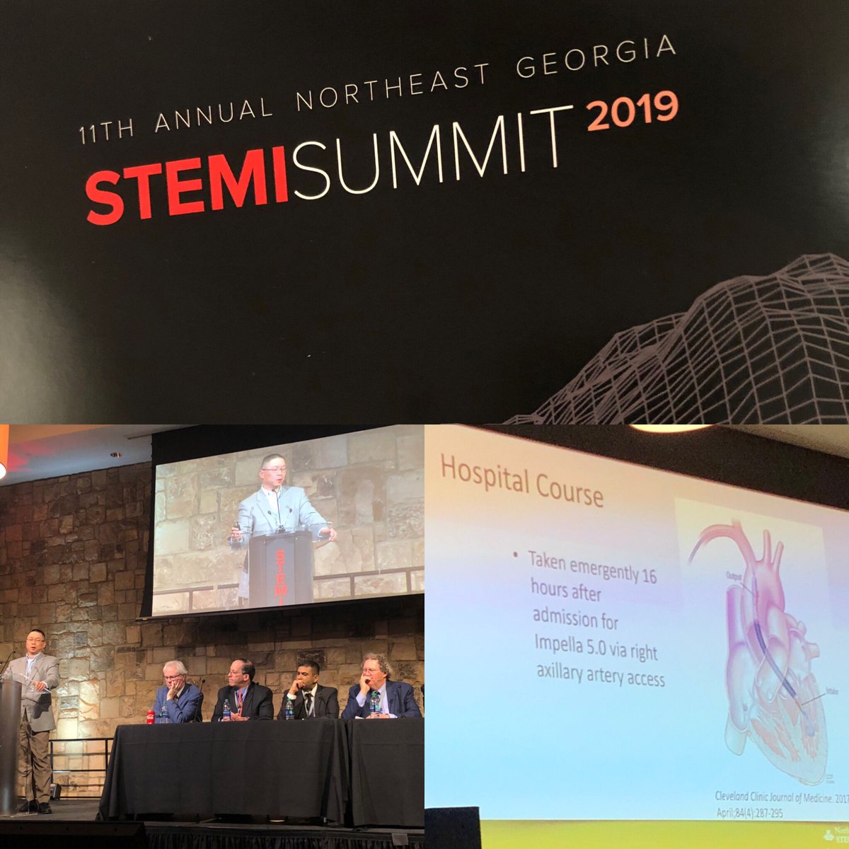 shonmd's tweet photo. Big things at the NE #Georgia #STEMI Summit. Dr. Andrew Yen discusses a case of refractory #AMICGS requiring escalation to #Impella 5.0.  41 YO patient survived to discharge against all odds.  

#waronshock @abiomedimpella @jjmarshallmd #heartrecovery #patientsfirst https://t.co/fn8BDLYUPC