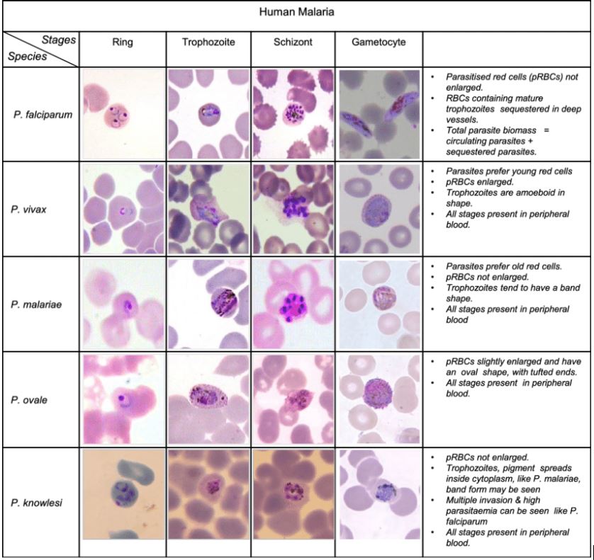 HeartPathology's tweet photo. Great visual aids I found along the way...(did NOT create these myself)

References:
Summary table peripheral blood: K. Silamut &amp; CDC
Simplified Life cycle diagram: Alan F. Cowman- Journal of Cell Biology 
Detailed Life Cycle: Le Roch Lab, UC Riverside https://t.co/YZtedABkWF