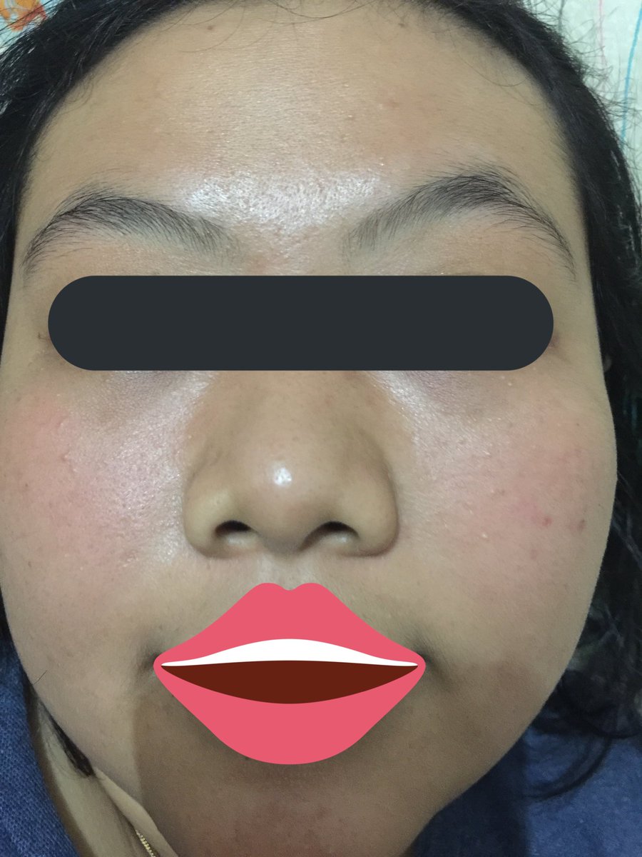 PENGALAMANKU MENCARI SKINCARE

a thread