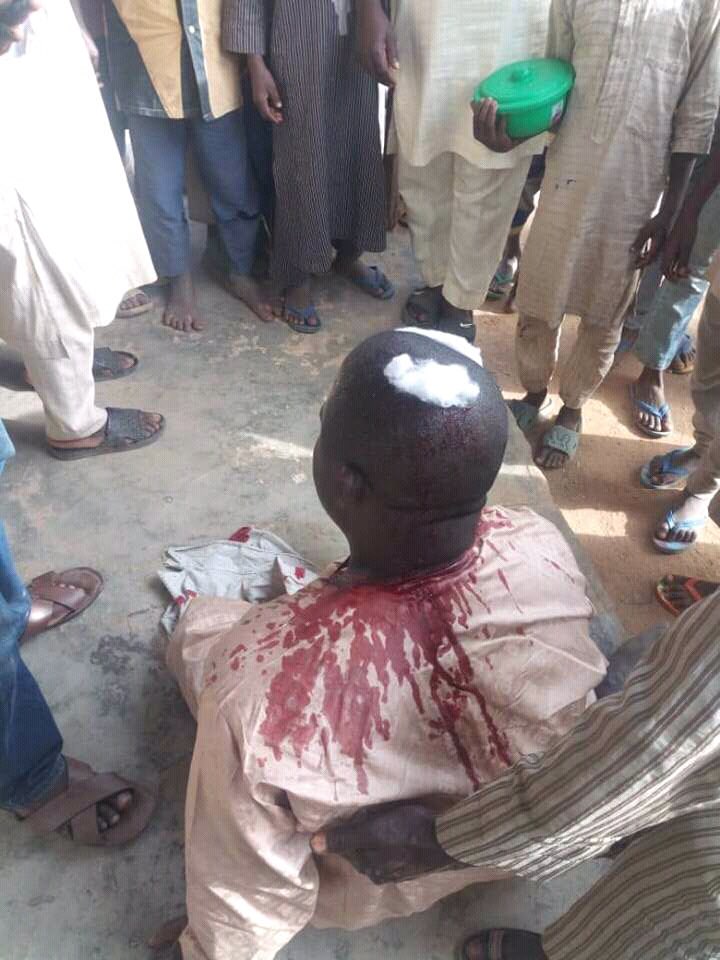 OfficialPDPNig's tweet photo. #SupplementaryElections #NigeriaDecides2019 Another @OfficialPDPNig agent, brutalized by @OfficialAPCNg thugs in Kano state. @inecnigeria and @PoliceNG, please take note. #KanoDecides https://t.co/p7qeZW4eKl