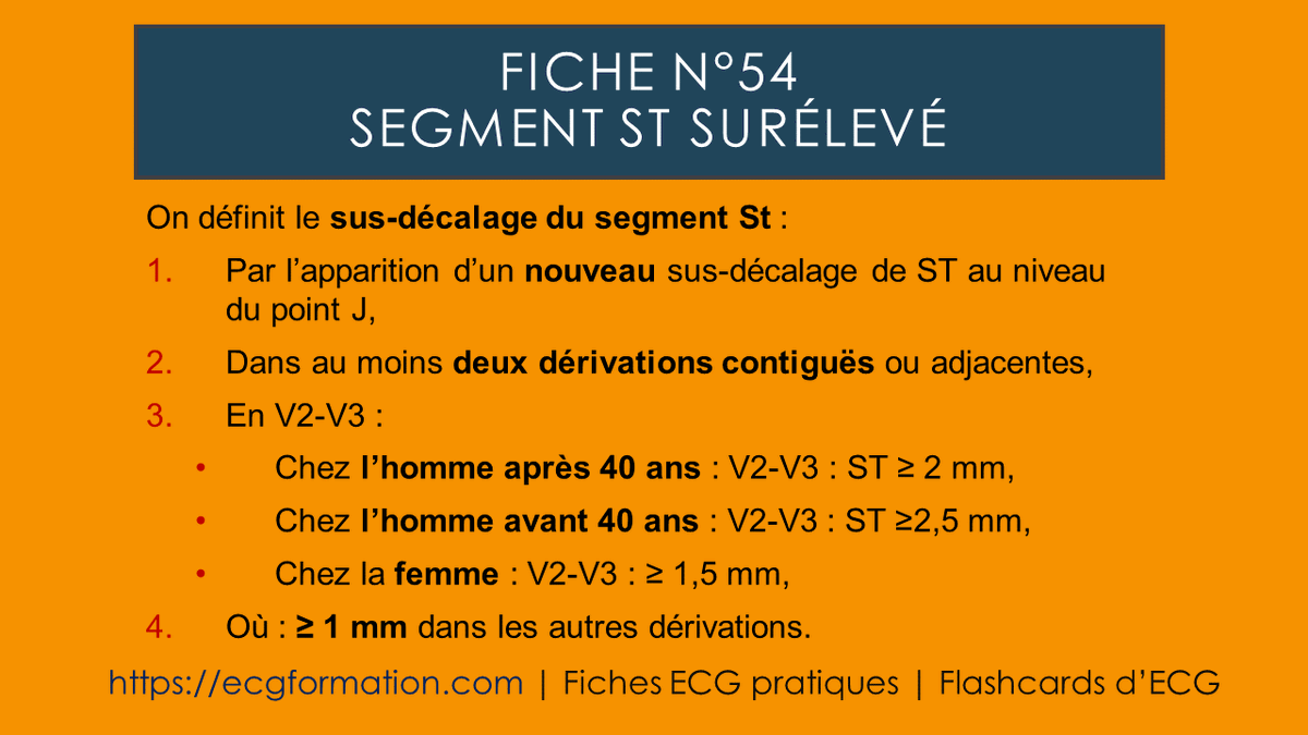 EcgFormation's tweet photo. Fiche N°54 | Sus-décalage du segment St.
#ecgformation #ecg #ekg #electrocardiogramme #cardiologie #cardio #formationecg #medecine #segmentst https://t.co/hX7zQWde98