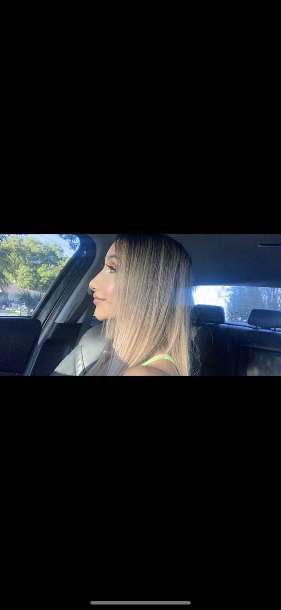 xocillaa__'s tweet photo. 8 months post op and this rhinoplasty was really the best thing to ever happen to me... I’m one happy girl now 🥰 https://t.co/SRtw8QSBhY