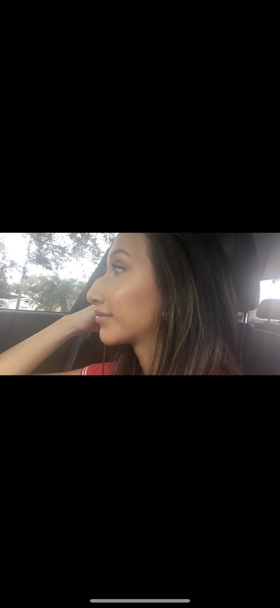 xocillaa__'s tweet photo. 8 months post op and this rhinoplasty was really the best thing to ever happen to me... I’m one happy girl now 🥰 https://t.co/SRtw8QSBhY