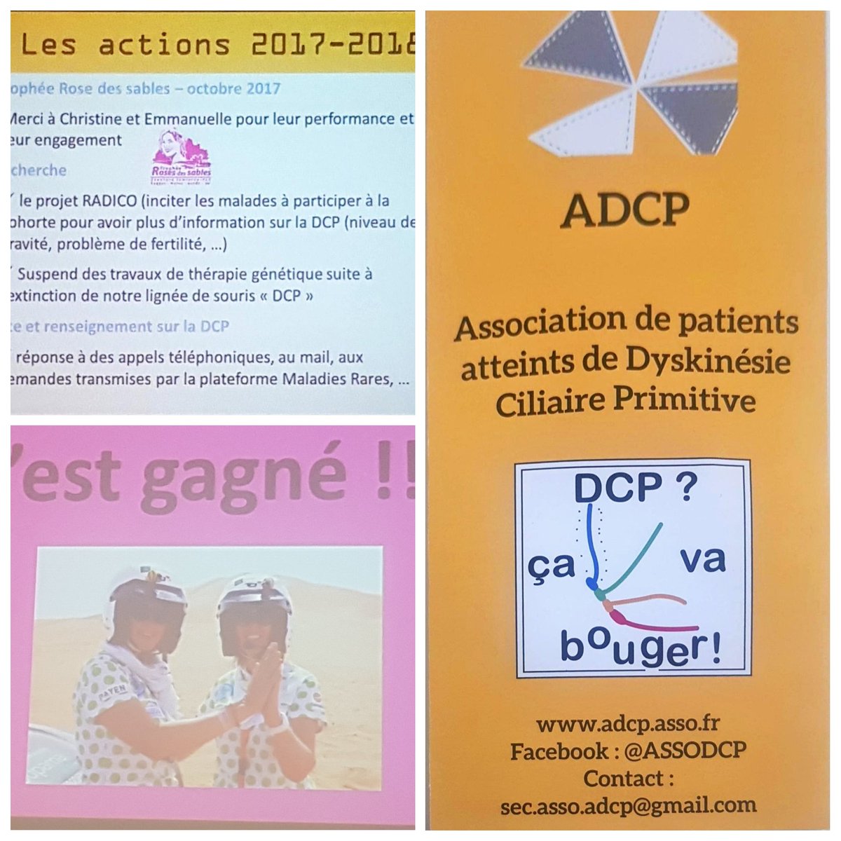 AG Association de Patients atteints de Dyskinesie Ciliaire Primitive.
Supports pédagogiques, échanges, formations, ADCP.asso.fr