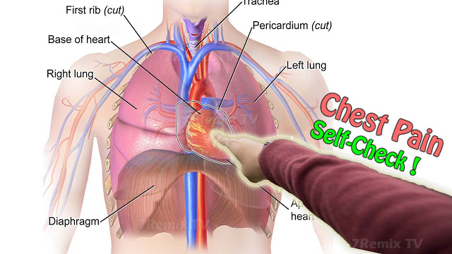 7RemixHT's tweet photo. What to do if my chest feels pain, here is what you should understand before rushing to doctor..!
https://t.co/LCkriugPqJ https://t.co/uIU5CGWiKh