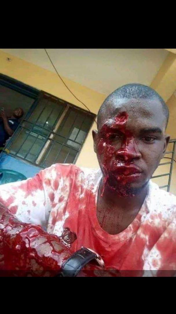 _wailingwailer's tweet photo. VIEWERS DISCRETION

Kano State is bleeding. Innocent people are attacked by APC thugs. 

@PoliceNG
@inecnigeria
@EU_Commission @USEmbassyAbuja https://t.co/Dc56XUdlVL