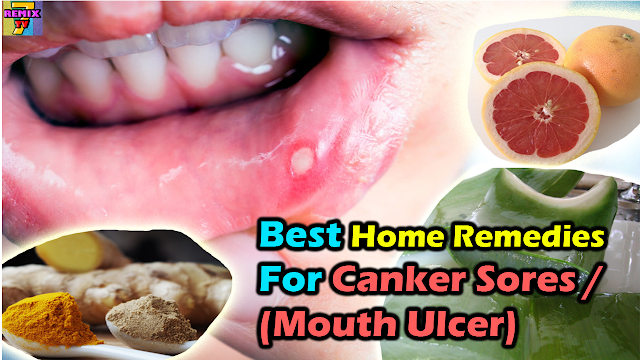 7RemixHT's tweet photo. How to Cure Canker Sores Fast Naturally | Best Home Remedies for Canker Sores
https://t.co/AlQaUpqA28 https://t.co/Z11JGiZHyQ