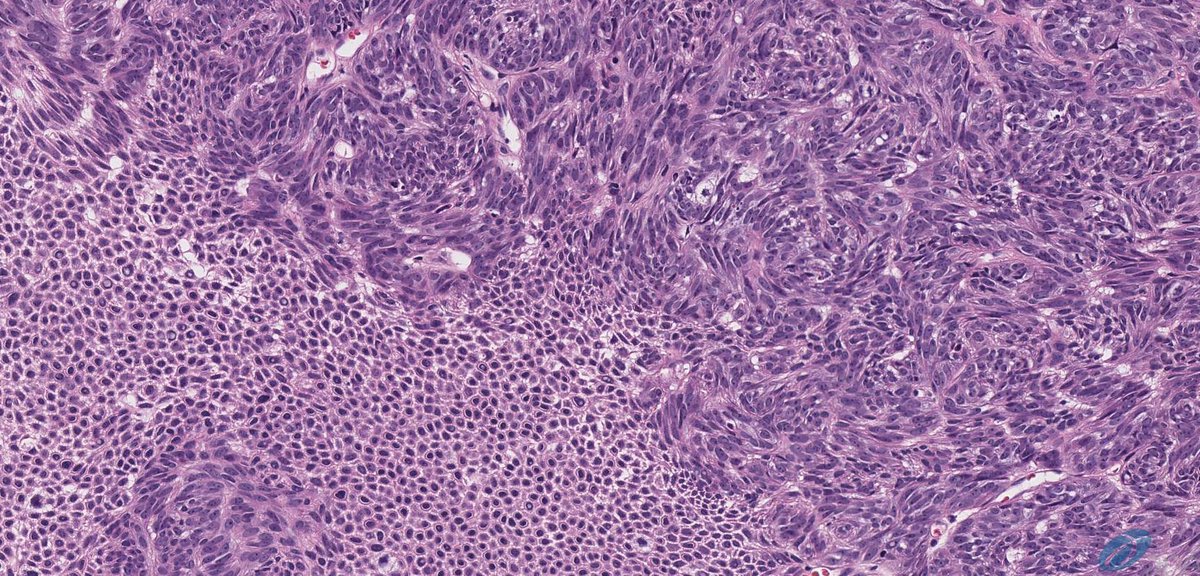 Int Soc Dermpath tweet media