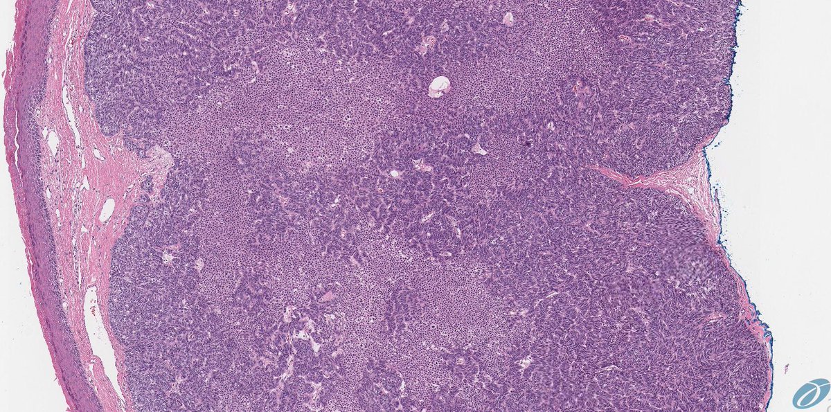 Int Soc Dermpath tweet media