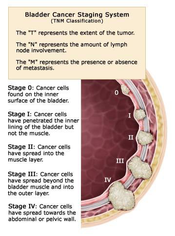 galenjournal's tweet photo. Comparative Bioinformatics Characteristic of Bladder Cancer Stage 2 from Stage 4 Expression profile: A Network-Based Study. Read the article at https://t.co/OlBZ8tCtiF: https://t.co/AaZ9wh4B9B #Bladder_Neoplasm #Transcriptor #Protein_Interaction_Maps #Bladder_cancer #Biomarkers https://t.co/wFYaYH1WcD