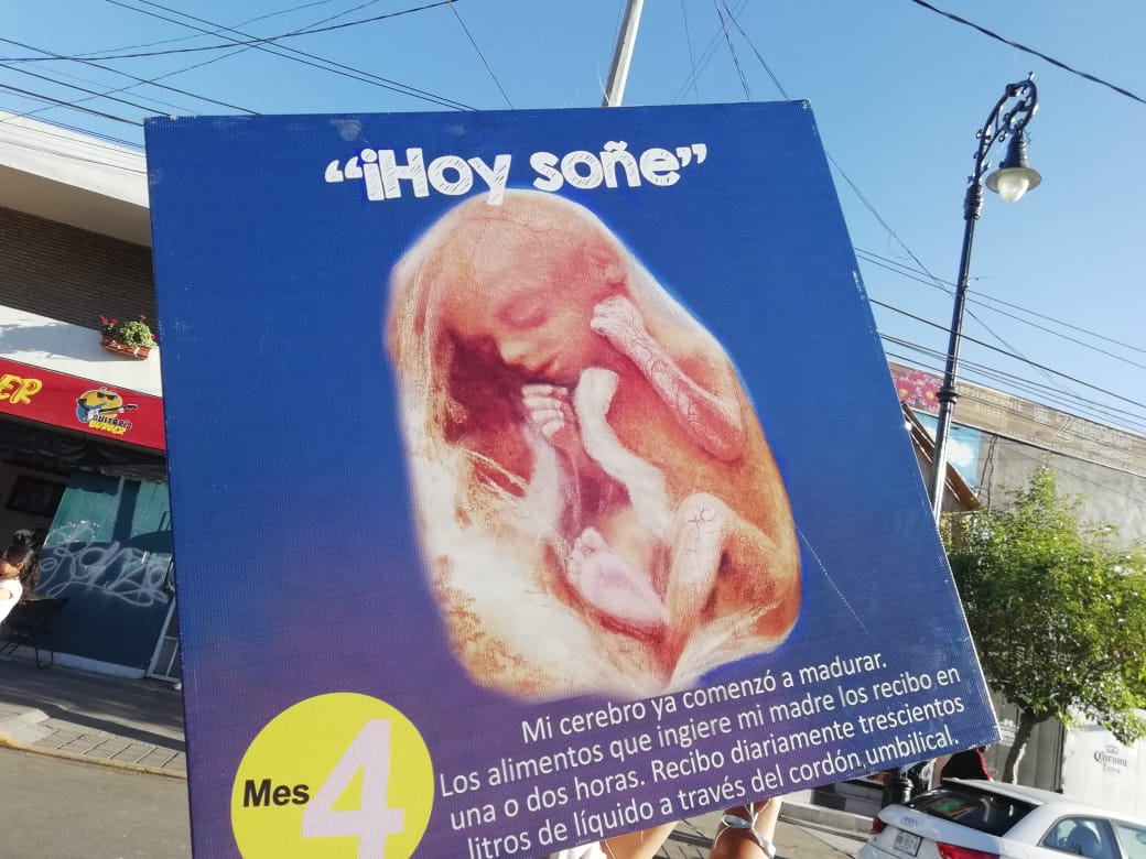 fnf_ags's tweet photo. Seamos nosotros su voz, defendamos su vida. #AgsEsVida
#SalvemosLas2Vidas
#DejaloLatir https://t.co/2NjqZiFGpJ