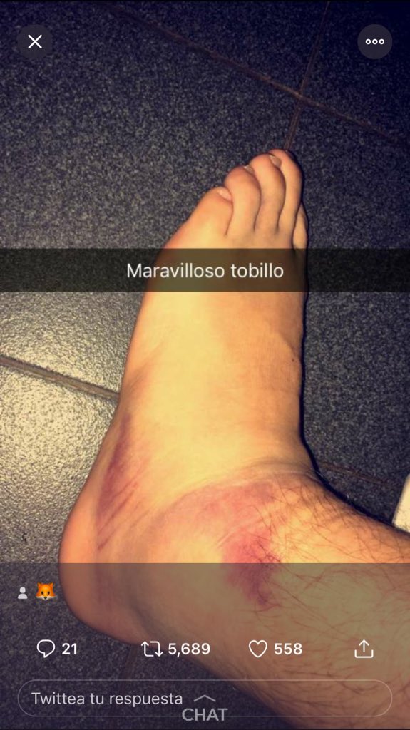 pepo_lombardi6's tweet photo. No le di rt y asi quede, rt o terminas asi https://t.co/W546UfdX2T