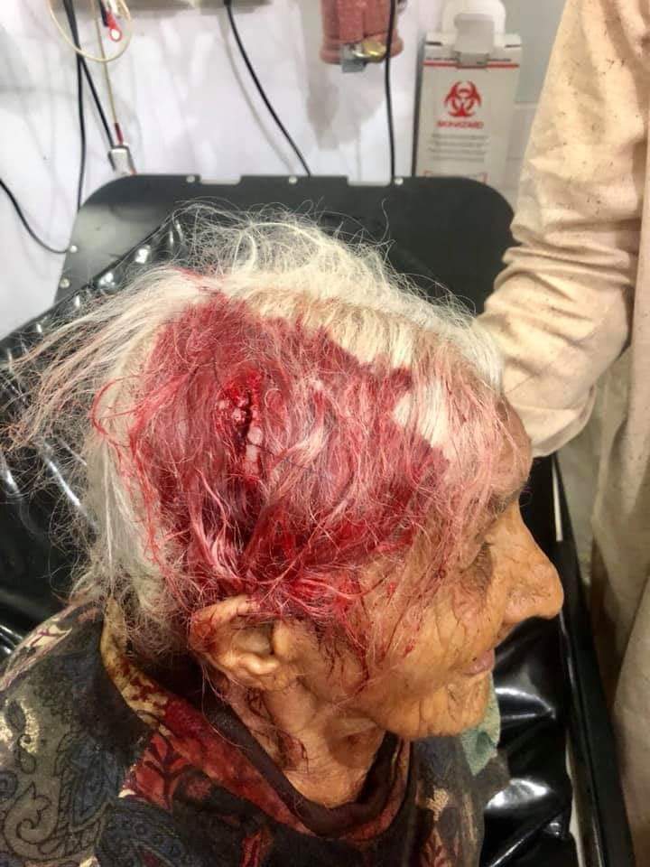 HaqGroupPeshaw1's tweet photo. Haq Grop Mardan
تیمرگرہ سٹی میں یہ ظلم اور زیادتی نہیں چلے گی۔۔۔
تیمرگرہ مرکز کے قریب بازار میں پولیس سپاہی نے بھیک مانگنے والی بوڑھی عورت کو دکھا دیکر لہو لہان کردیا جس پر افسوس کا  اظہار کرتے ہیں اور ڈی پی او صاحب سے مطالبہ کرتے ہیں کہ ان کے خلاف محکمانہ کاروائی کرکے انجائے۔۔۔ https://t.co/MA5LYmgp4g