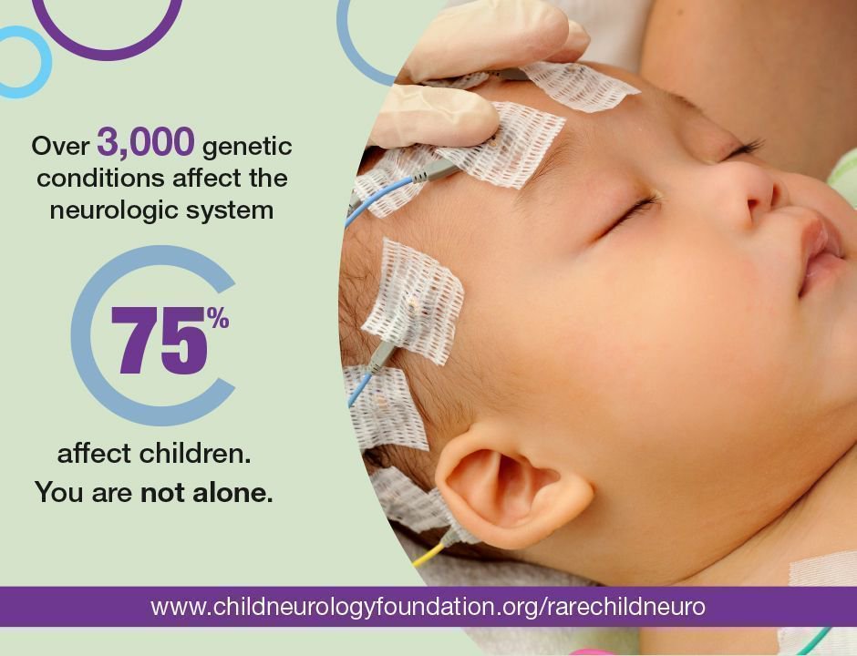 Child_Neurology's tweet photo. Over 3,000 genetic conditions affect the neurological system. 75% of these conditions affect babies and children.CNF &amp; @GlobalGenes along w/ their partners have teamed up to better understand this community. YOU ARE NOT ALONE Rare Child Neurology Workgroup https://t.co/QrefQFrYLY https://t.co/WSW33w1FYP