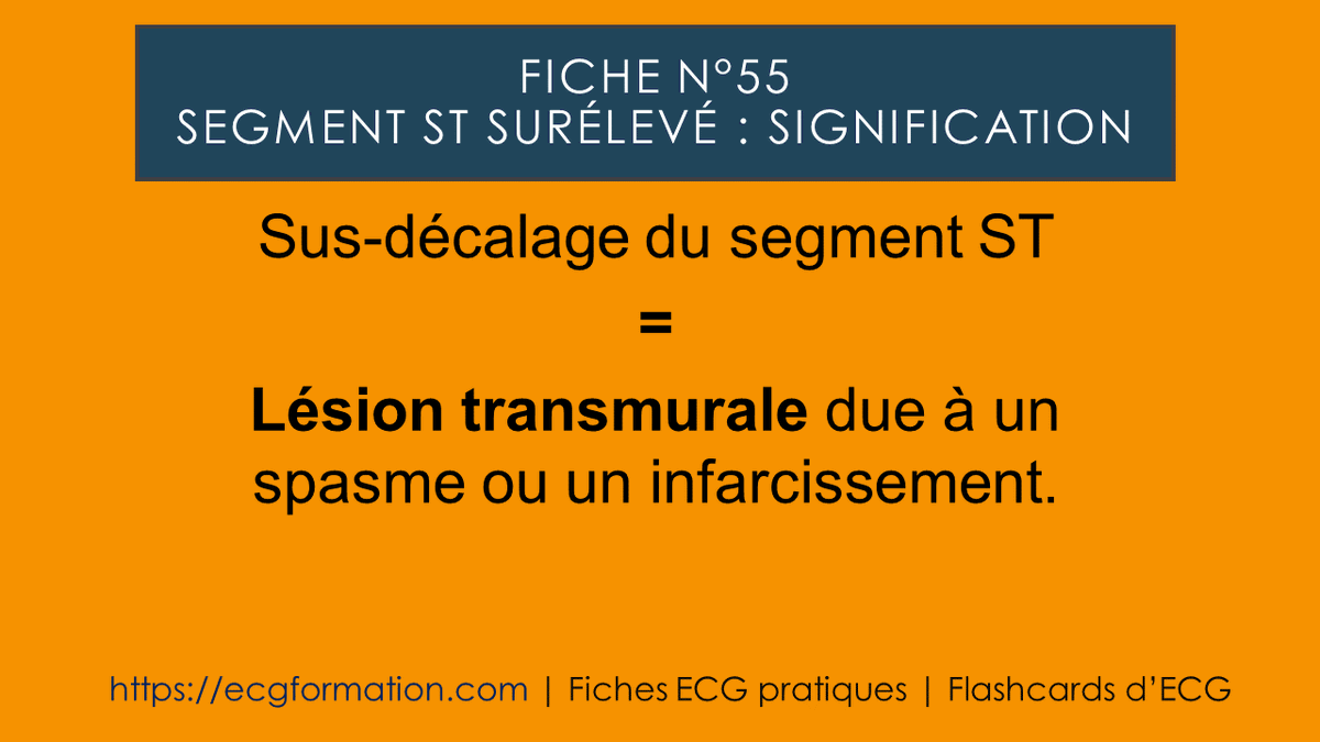 EcgFormation's tweet photo. Fiche N°55 | Sus-décalage du segment St : signification. https://t.co/xFupb09m6T