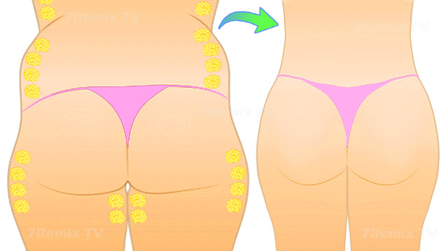 7RemixHT's tweet photo. How To Reduce Buttock Fat With 5 Moves For Your Butt, Hips And Thighs
https://t.co/F8krXp72Z6 https://t.co/buE2uwuCI8