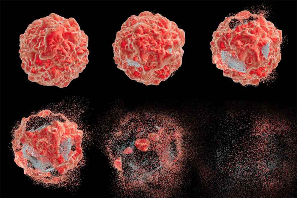 What Is Cancer And Some Types Of Cancer? - magazish.com/2018/09/21/wha…