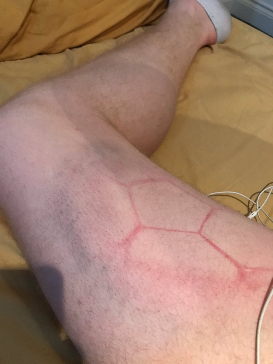 ben_tye's tweet photo. Pretty sure I blocked the worlds hardest shot yesterday https://t.co/Tn8JhPwAhC