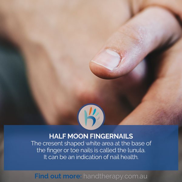 Have you ever wondered what the half moon white area on your fingernails means?
#handtherapy #tips #health #handtherapist #physiotherapy #hand