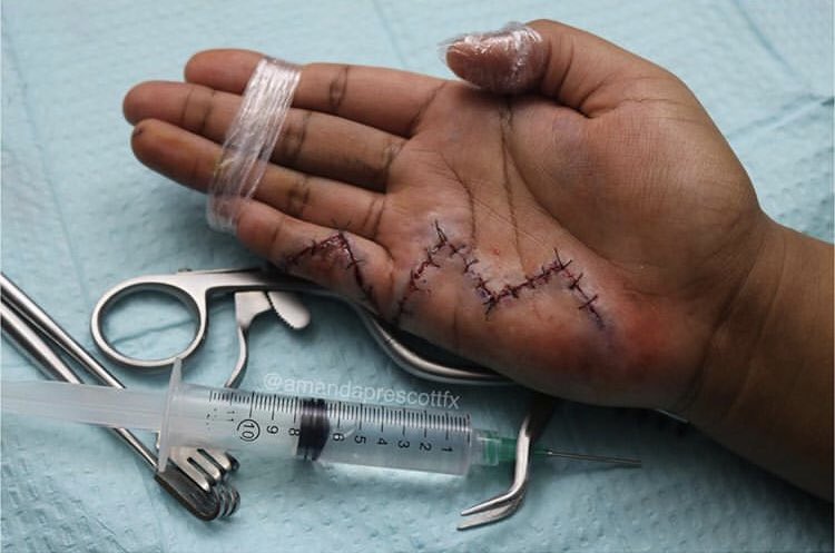 prescottfx's tweet photo. Tendon Repair Surgery Makeup🎨💉
.
.
.
.
#Surgeon #surgery #doctor #gored #Blood #art #makeup #artistsoninstagram #mua #makeuplover #makeupschool #stitching #sewing #knitting #sfx #specialeffects #operation #er #hospital https://t.co/LZHfCwqyXi