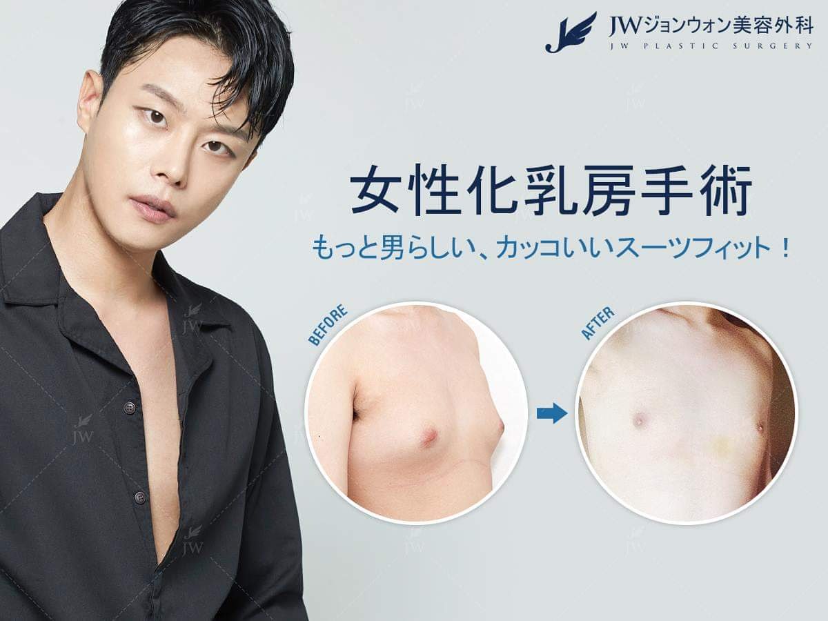 JW ジョンウォン美容外科 on Twitter "👦🧚‍♀️男性の胸が女性の胸のように肥大になる疾患を情勢下乳房といいます。女性化乳房は