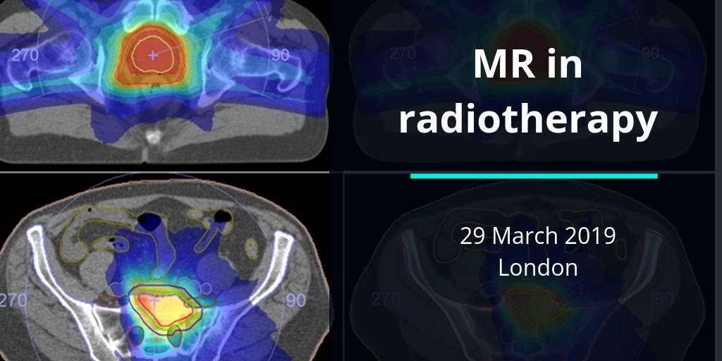 BIR_News's tweet photo. Last chance to book!The '#MR in #Radiotherapy' event will bring leaders in the field of MR #imaging based solutions for radiotherapy applications together. It will inform best practice and practical approaches to overcoming challenges in these specialties. https://t.co/eRFcXrnRST https://t.co/7M2BDliPmp