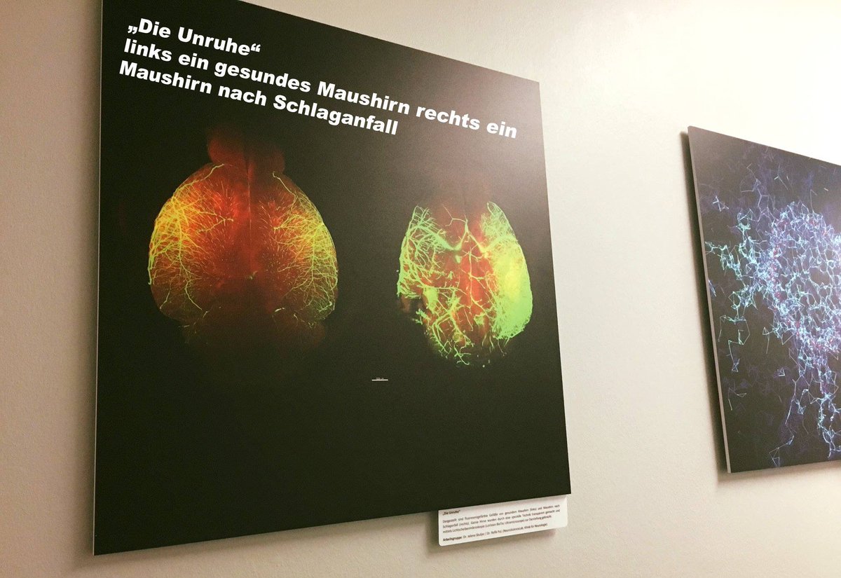 UniklinikEssen's tweet photo. Diese tollen Aufnahmen hängen in den Fluren unserer #Neurologie🙂Die Bilder entstehen durch die Lichtscheibenmikroskopie. Diese zeigen die Gefäße von Maushirnen - rechts nach #Schlaganfall und links gesund. Entwickelt im #NeuroScienceLab der AG Dr. Jelena Skuljec & Dr. Refik Paul https://t.co/cvO819Wfpe