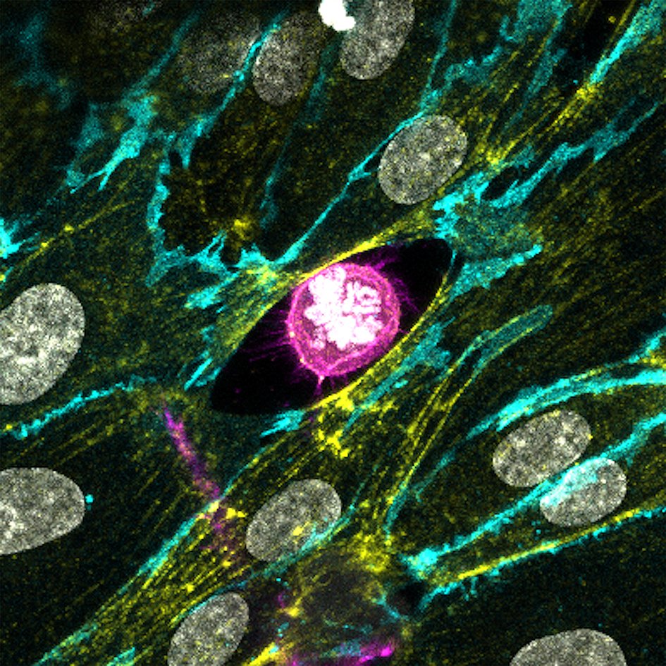 breastCRA's tweet photo. Every year our researchers submit outstanding pictures to our Science and Medical Imaging Competition – telling a story about our pioneering work and its benefits for patients.… To read further, click below https://t.co/R8jTH6Bb99 https://t.co/ThdGIt0vHk
