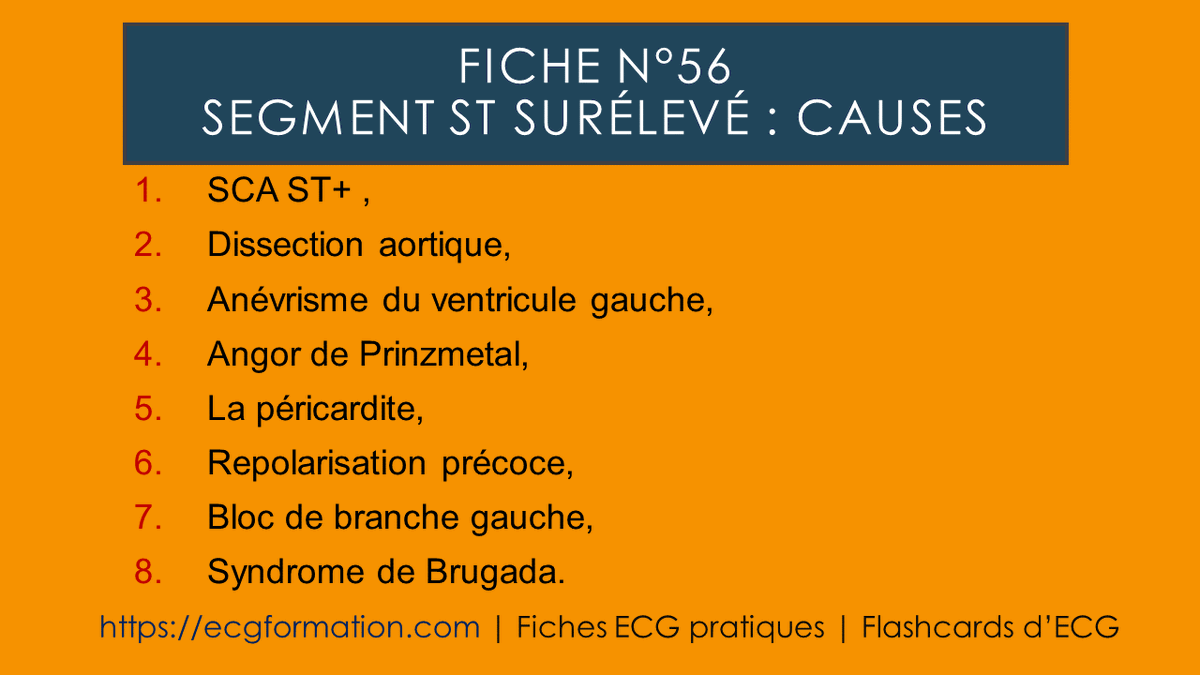 EcgFormation's tweet photo. Fiche N°56 | Sus-décalage du segment St : causes.
#ecgformation #ecg #ekg #electrocardiogramme #cardiologie #cardio #formationecg #medecine #segmentst https://t.co/2IObKeMFii
