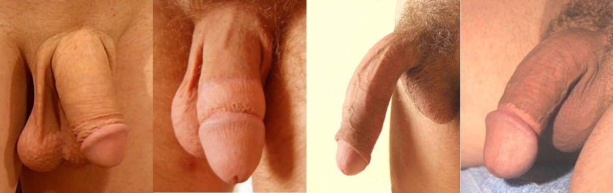 cutbro69's tweet photo. The four types of circumcision! which one do you have? Im like the first one. #teamcut #circumcision #circumcised #circumsexual #circumcisionstyles https://t.co/79pfy6fEcX