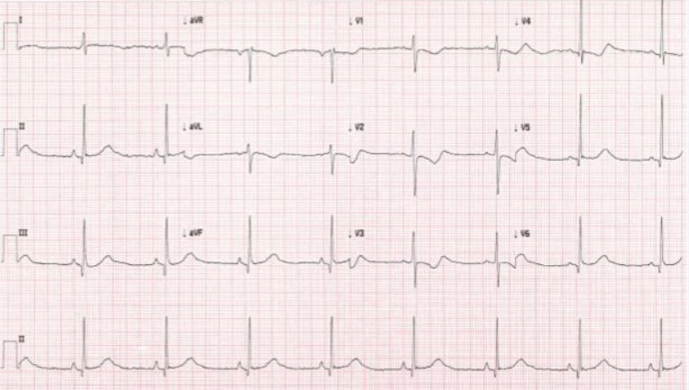 escardio's tweet photo. What better way to start your warm up for #EuroPrevent than w/ a #sportscardiology quiz 😀Full challenge on our FB page https://t.co/xu4u9QMZMP
Want the best in #cvprev learning? Have it all during #EuroPrevent https://t.co/KcvnCKQQIf
#cardiotwitter #EAPC_ESC #cvdprev https://t.co/ZK6hQNKVaJ