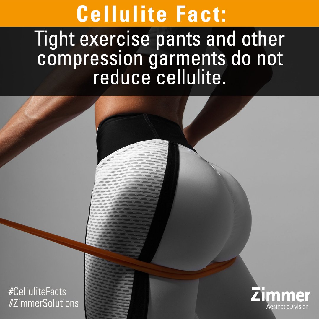 Zimmer_USA's tweet photo. Cellulite Fact: Tight exercise pants &amp; other #compression garments do not reduce #cellulite. In fact, wearing tight pants / underwear may potentially have the opposite effect, worsening cellulite over time, by slowing or cutting off blood flow.

#CelluliteFacts #ZimmerSolutions https://t.co/xKtdaUBpnI