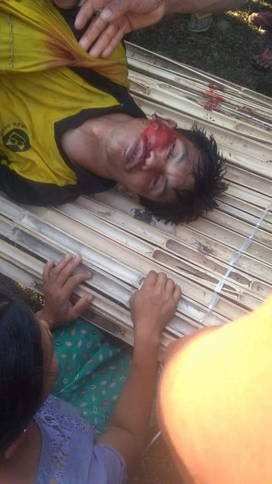 How cruel! 
A boy from #Amyataung village
under #Rathedaung township #Rakhine(#Arakan)
was brutally shot to death 
without any definite reason 
by #Burmese #colonists called 
as #Burmese Army. 
Such a well-bred son 
was lost.<a href="/YangheeLeeSKKU/">Yanghee Lee</a> <a href="/antonioguterres/">António Guterres</a> <a href="/AP/">The Associated Press</a> <a href="/eucopresident/">António Costa</a> <a href="/FT/">Financial Times</a>