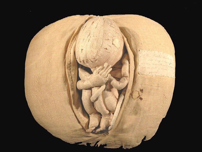 WhoresofYore's tweet photo. Angélique-Marguerite du Coudray was an 18th century midwife &amp; designed these mannequins to train new midwives. Louis XV asked her to set up midwifery courses throughout France. From 1759-1779 she traveled the country with her mannequin &amp; wrote “Abridged Art of Child Delivery” https://t.co/yDORn3Kt4l