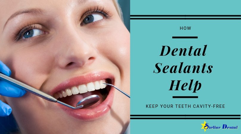 Getting a tooth cavity is one of the most common dental problems. If left unchecked, cavities can grow and cause damage to your teeth. Read more.  stellardentalllc.com/blog/how-denta… #dentalsealants #teethcavity