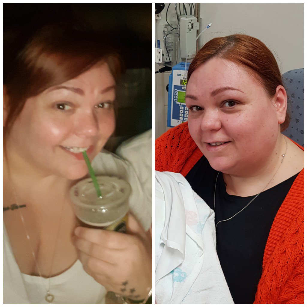 runaroundsue09's tweet photo. 7 weeks apart #slimmingworld #45lbsdown 💪🥊 https://t.co/YU6E3YdqGR