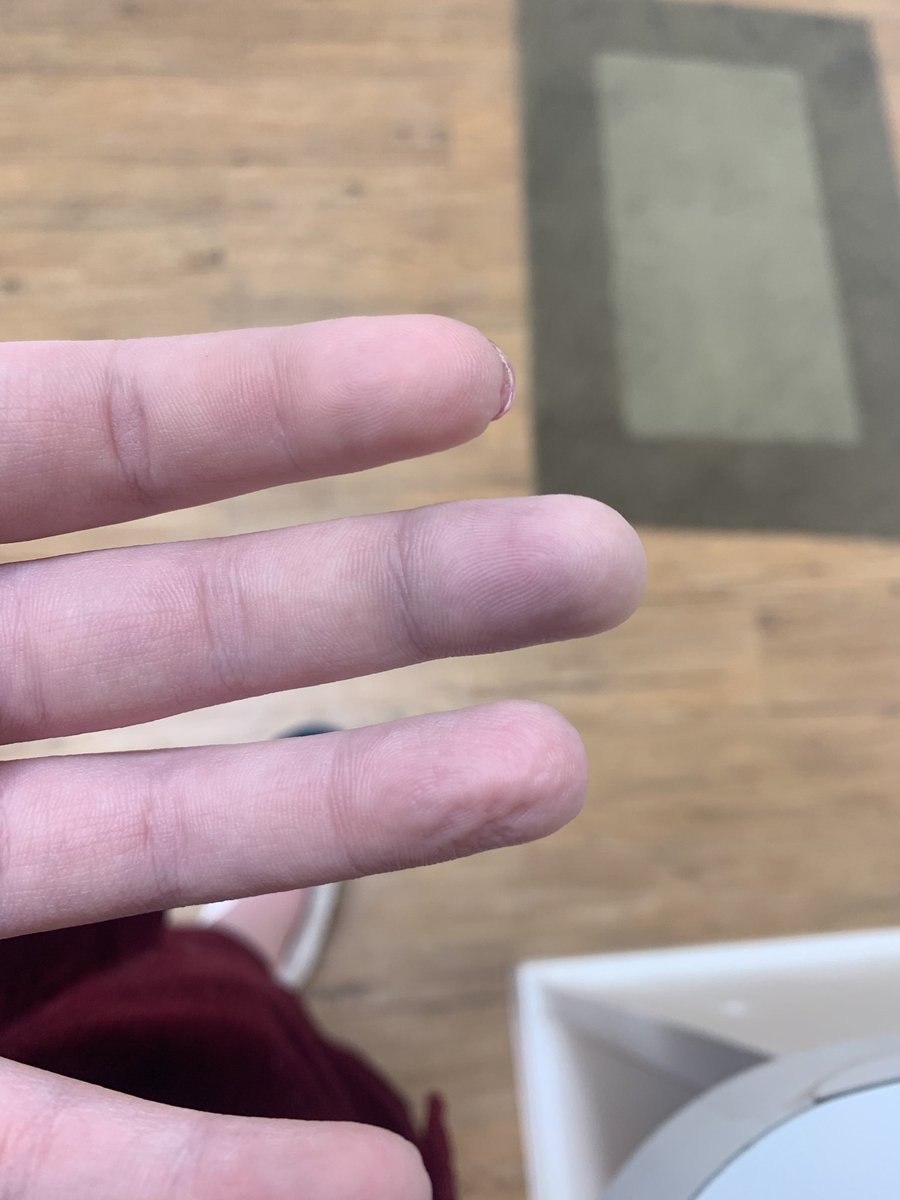 1991Shitposting's tweet photo. I broke my finger in the middle of a goodwill and everyone heard it. https://t.co/T1KR8Vqy4S