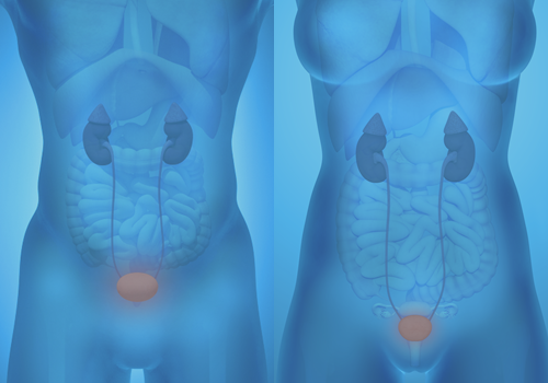 DStrovski's tweet photo. Bladder cancer develops when cells begin to grow abnormally. These cells develop mutations that cause them to grow out of control and not die. These malignant cells form a tumor. https://t.co/vdlNEiKx2D