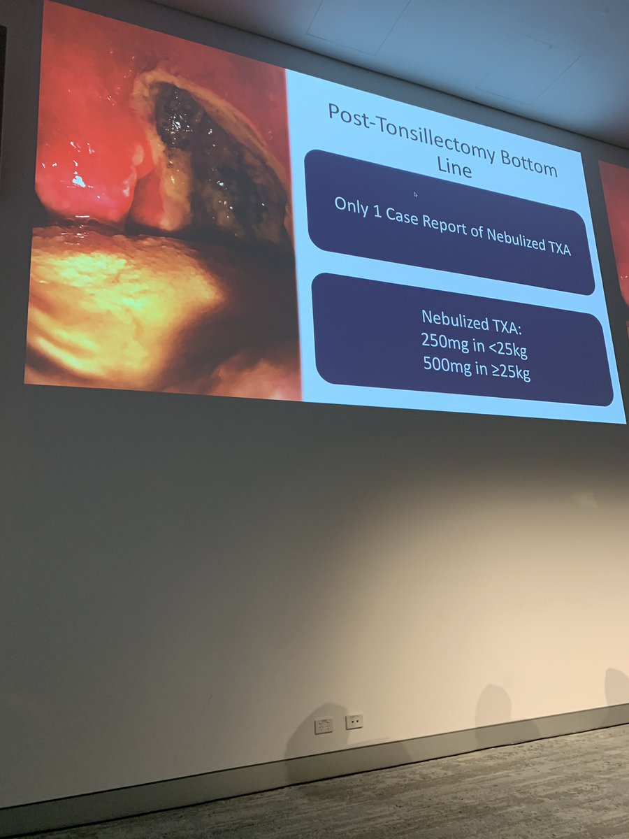 LWestafer's tweet photo. TXA for post tonsillectomy bleed #smacc #EMupdates @srrezaie https://t.co/0viTWjLYFh https://t.co/OenduY1xQn
