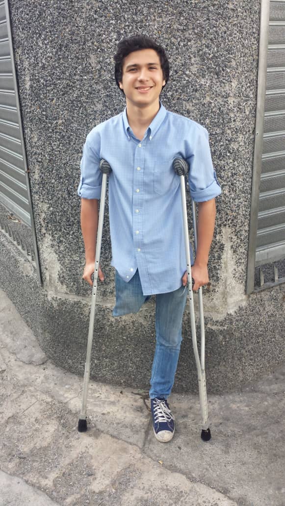 MamaLisVzla's tweet image. Namik de 18 años perdió su pierna a causa de Osteosarcoma. Gofundme canceló su campaña por vivir en Vzla, por eso lo haremos a través de esta Fundación. Nos urge reunir 3000$ para su prótesis. Donen a través de nuestro Gofundme o por zelle. #LuchaContraElCancer