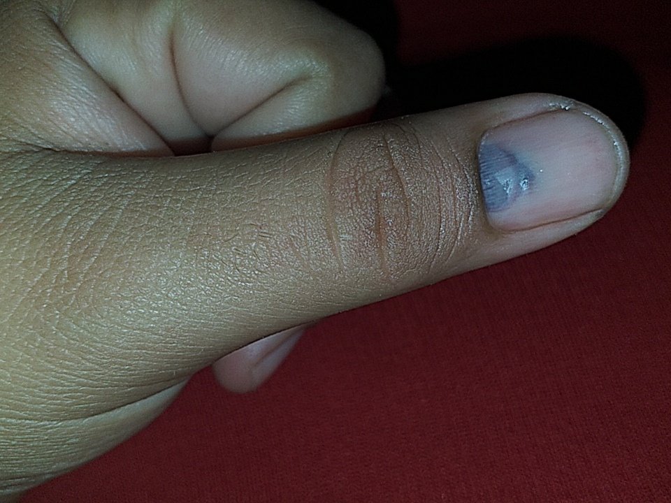 Azul20261675's tweet photo. No es decoracion, si no un machucon 😔😥😭
#horribledia
#noesmidia
#quierollorar
#ByeBye
#HastaLuego https://t.co/MIktcPzUH2