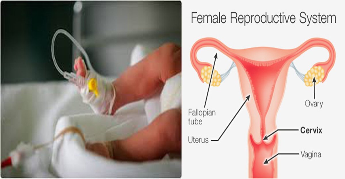 What is Cervix  Bacteria 

over-the-counterdrug.net/2019/03/what-i…