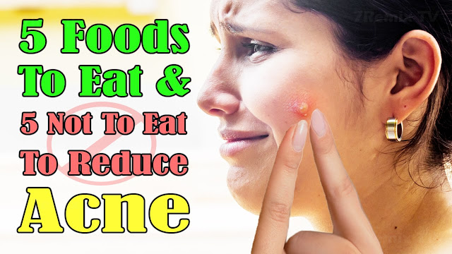 7RemixHT's tweet photo. 5 Foods To Eat and 5 Foods Not To Eat To Reduce Acne Outbreaks Fast &amp; Naturally.
https://t.co/SoiOsGXaXk https://t.co/WauR5N2UzZ