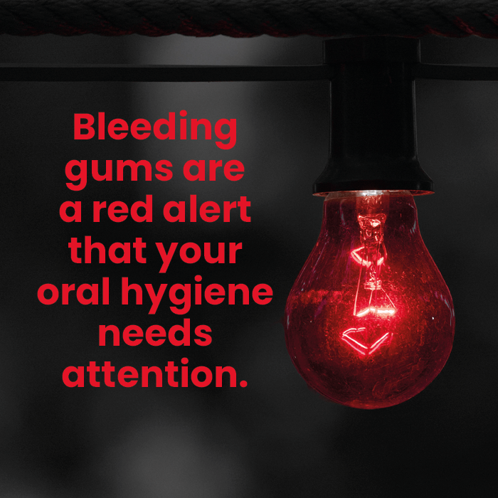 Bleeding gums indicate gum disease - which, caught early, can be reversed. See our hygienist for a professional deep clean and tailored tips and techniques to fight gum disease. #dentistry #oralhealth #dentalappointment #dentist #dentalhygiene
