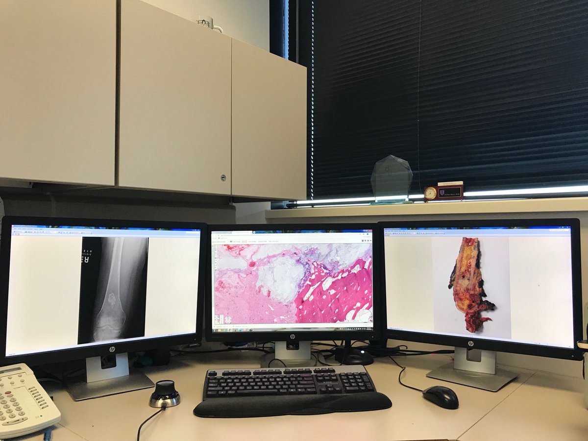 borysd01's tweet photo. This is my workstation at my office. Hope soon all pathologist will use Digital Pathology workstations. Much more comfortable and no more neck pain. By the way what do you think about the case on the screen. https://t.co/hpO8Hu1Hnb