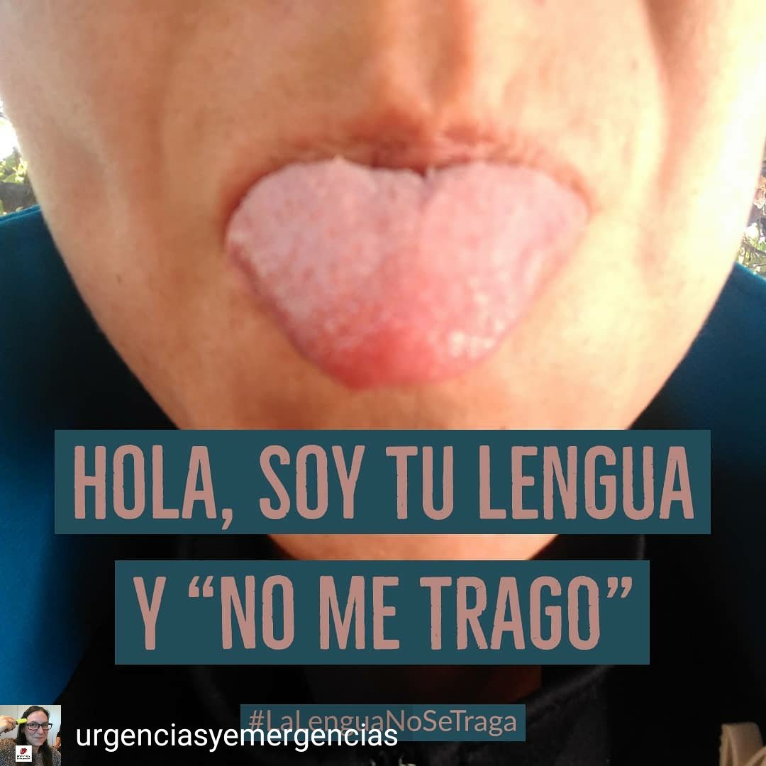 urgenciasemerge's tweet photo. "Hola, soy tu lengua y no me trago" 

#LaLenguaNoSeTraga

No se meten los dedos en la boca de alguien inconsciente.

NO SE METEN LOS DEDOS EN LA BOCA DE ALGUIEN INCONSCIENTE.

#LALENGUANOSETRAGA 
#InstaDocenciaSalud 
#StopBulosSalud  -  https://t.co/yzmXions9d https://t.co/95SAzNNJYx